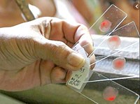 Diễn biến kháng thuốc do chủng Plasmodium falciparum và vai trò của các chỉ điểm phân tử tại các quốc gia trong tiểu vùng sông Mê Kông