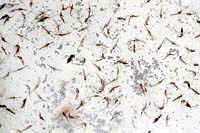 Một bí ẩn của bệnh sốt rét đã được làm sáng tỏ: Điều gì xảy ra khi mùa mưa kết thúc?