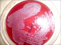 Báo cáo một ca bệnh vi khuẩn ăn thịt người Melioidosis (Whitmore)