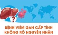 Tăng cường giám sát các trường hợp viêm gan cấp tính không rõ nguyên nhân ở trẻ em