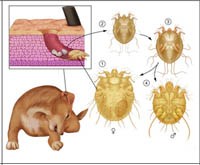 Vào mùa hè - nhiễm ký sinh trùng ghẻ xuất hiện nhiều hơn trên cả người lớn và trẻ em
