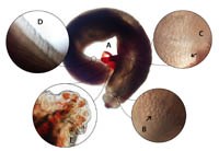  Điều trị nội khoa và ngoại khoa trong bệnh lý ấu trùng giun đầu gai Gnathostoma spp. ở người (Phần 1)