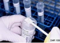 Một số hóa chất thường sử dụng trong phòng xét nghiệm ký sinh trùng, giun sán và đơn bào