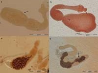 Cập nhật nghiên cứu về bệnh do sán dải chó (echinococcosis) ở người trên thế giới và Việt Nam (Phần 2)