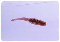 Cập nhật nghiên cứu về bệnh do sán dải chó (echinococcosis) ở người trên thế giới và Việt Nam (Phần 1)