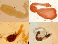Cập nhật nghiên cứu về bệnh do sán dải chó (echinococcosis) ở người trên thế giới và Việt Nam (Phần 4)