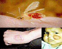 Leishmania donovani: Loài ký sinh trùng đơn bào gây bệnh truyền nhiễm ở người đang nổi tại Việt Nam? (Phần 2)