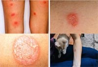 Nhiễm nấm ở người từ việc nuôi thú cưng bệnh lý lâm sàng ngày càng gặp phổ biến ở kỷ nguyên hiện đại (Phần 2-Hết)