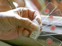 Các xét nghiệm chẩn đoán phát hiện nguy cơ tái phát của sốt rét do Plasmodium vivax: Các đặc tính sản phẩm ưu tiên