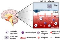 Một số bệnh phổi do nhiễm ký sinh trùng ở người (Phần 3-Hết)