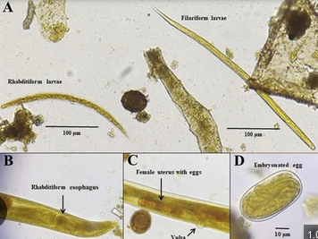 Cập nhật Hướng dẫn Tổ chức Y tế Thế giới về điều trị dự phòng bệnh giun lươn giảm gánh nặng bệnh tật ảnh hưởng đến sức khỏe cộng đồng (Phần 1) (còn nữa)