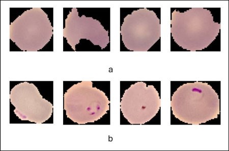 Khung đa mô hình tự động hóa để phát hiện sốt rét áp dụng học sâu kết hợp (Phần 3)