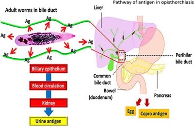 Chẩn đoán bệnh sán lá gan nhỏ ở người thông qua mẫu bệnh phẩm nước tiểu