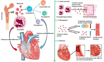 Hội chứng löffler và những điều liên quan đến nhiễm ký sinh trùng qua hệ hô hấp