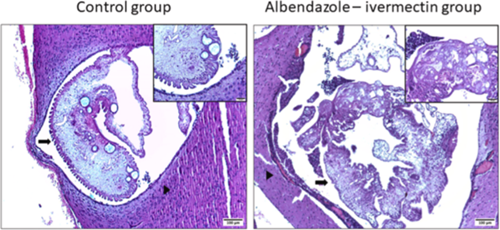 Cơ quan Quản lý Dược phẩm Châu Âu đưa ra quan điểm tích cực về thuốc phối hợp liều cố định albendazole-ivermectin trong điều trị một số bệnh ký sinh trùng giun, sán ở người (Phần 3-Hết)